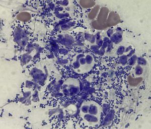 A close up of a bacterial slide.